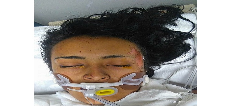 Mujer camina herida al hospital desde el mercado de Tultepec