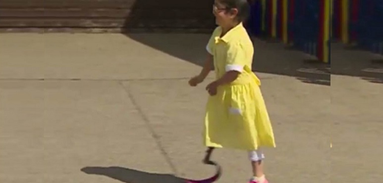Video de niña con prótesis conmueve redes sociales