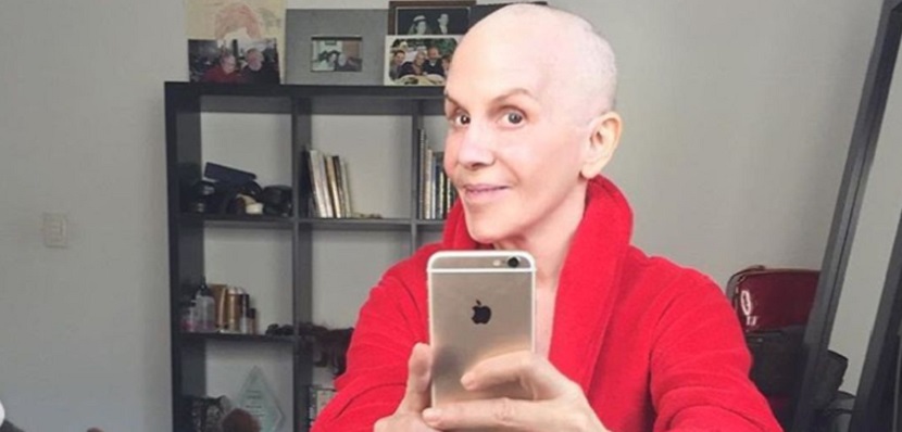 Rebecca Jones muestra el duro momento en que se rapó por el cáncer