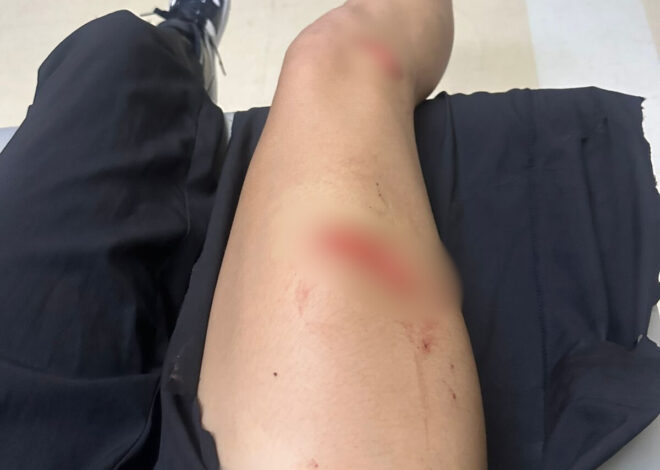 Fiscalía investiga agresión contra joven en Ciudad Obregón