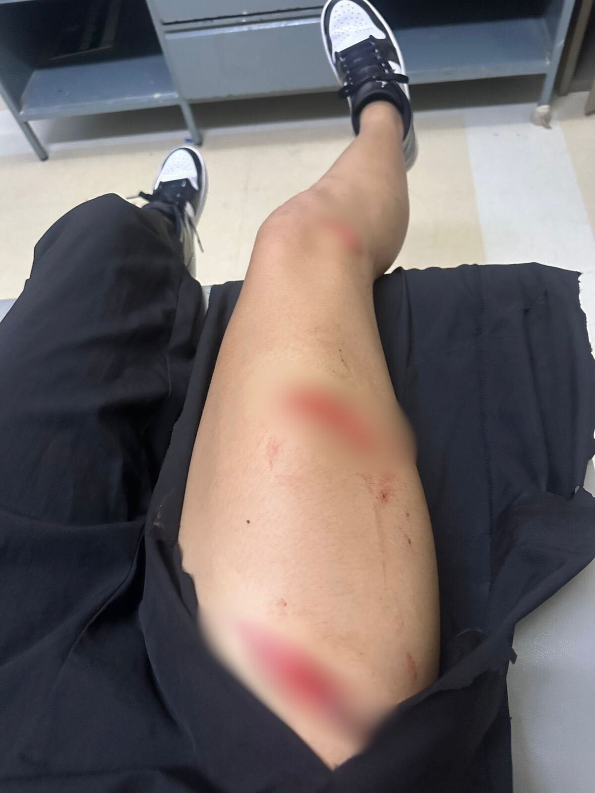 Fiscalía investiga agresión contra joven en Ciudad Obregón